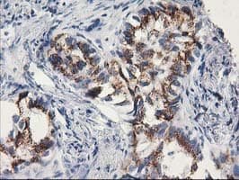 MGLL / Monoacylglycerol Lipase Antibody (clone OTI2G8)