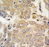 Polyclonal Rabbit anti-Human MAPK4 / ERK4 Antibody (aa72-101, IHC, WB)