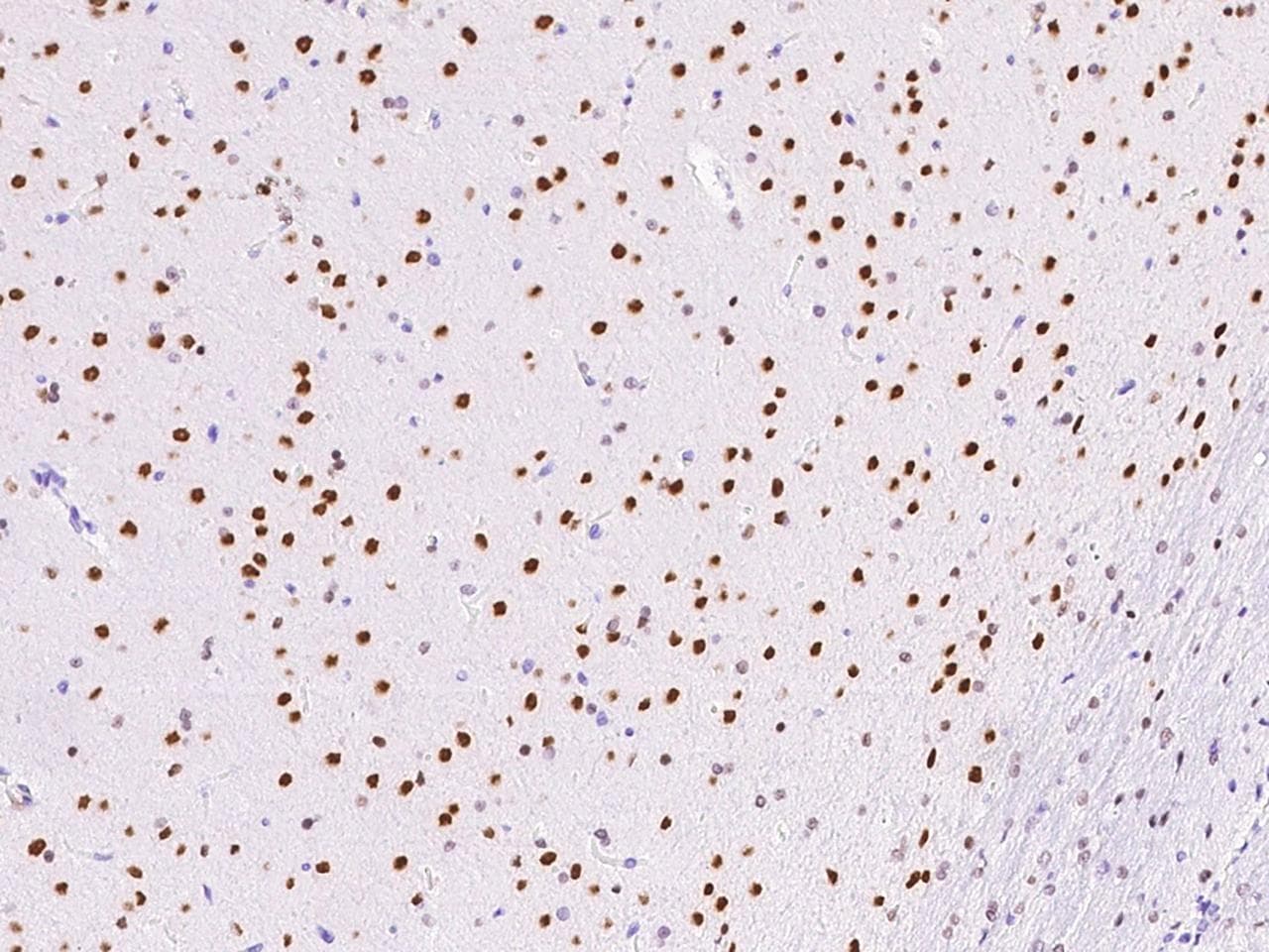 ONECUT1 / HNF6 Antibody (Preservative Free)