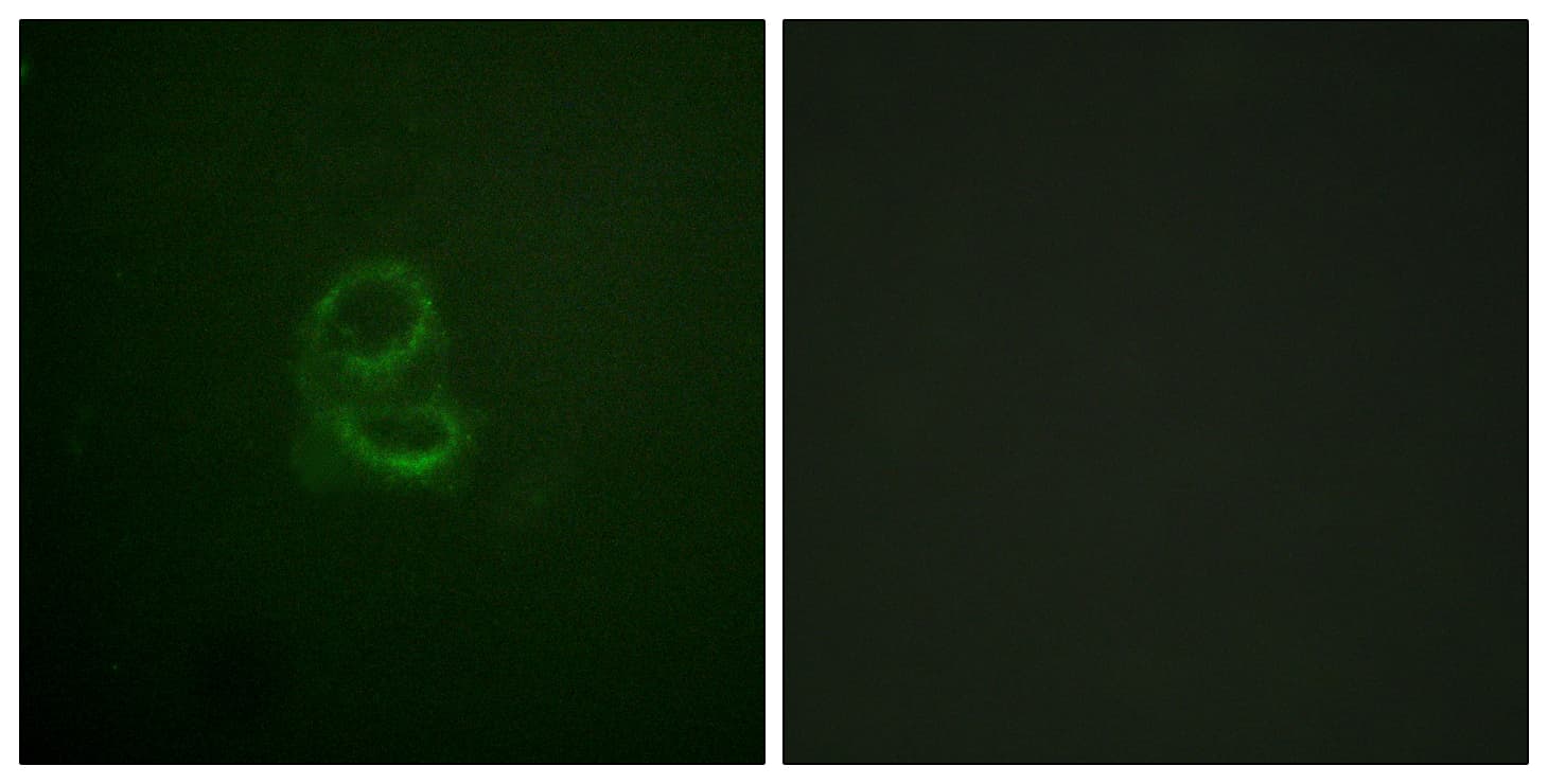 IL4R / CD124 Antibody (aa463-512)