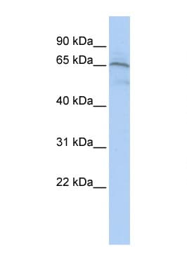 AIFM1 / AIF / PDCD8 Antibody (C-Terminus)