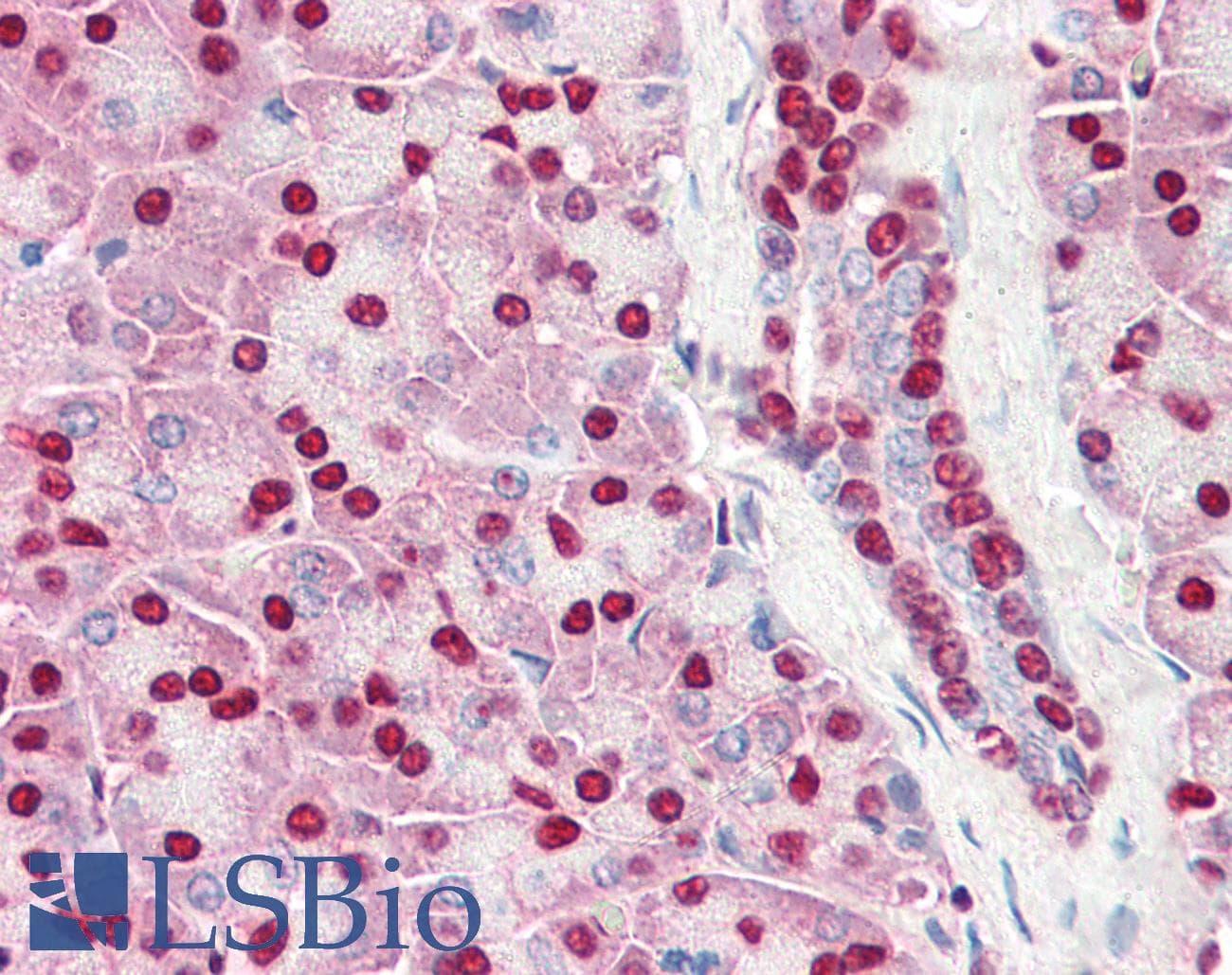 PathPlus™ Polyclonal Rabbit anti-Human ACIN1 / Acinus Antibody (IHC, IF, WB)