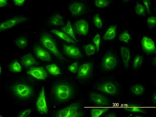 IHC-plus™ KRT81 / Keratin 81 / KRTHB1 Antibody (clone 3B10-5B10)
