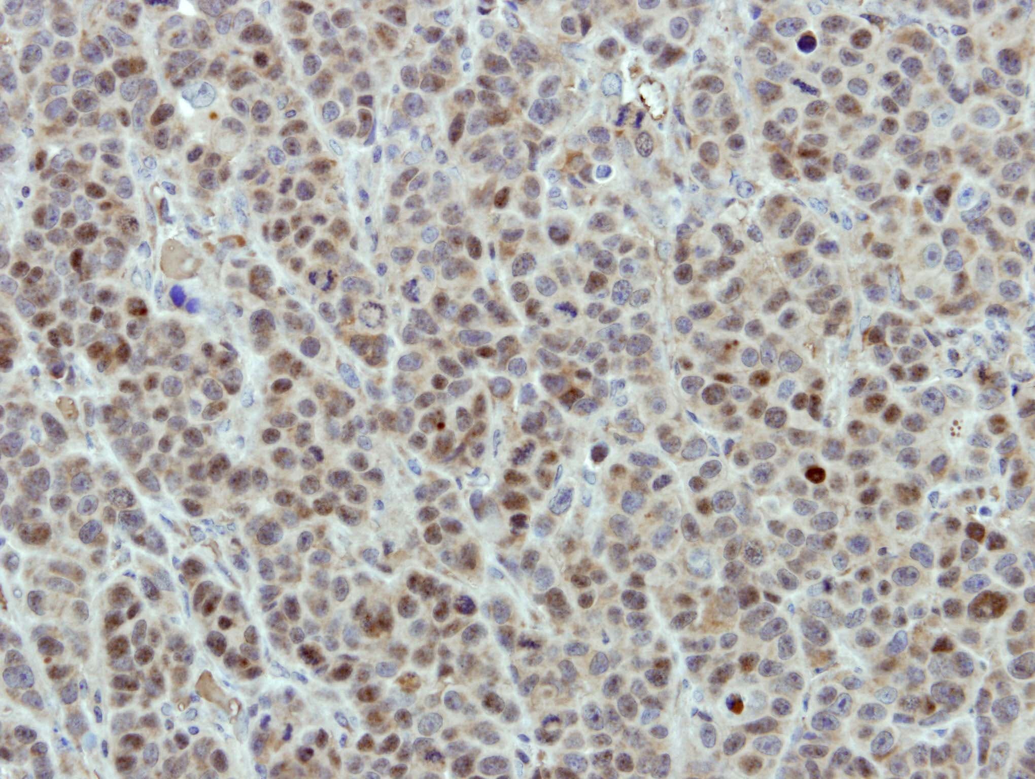 DDX56 Antibody (aa201-393)