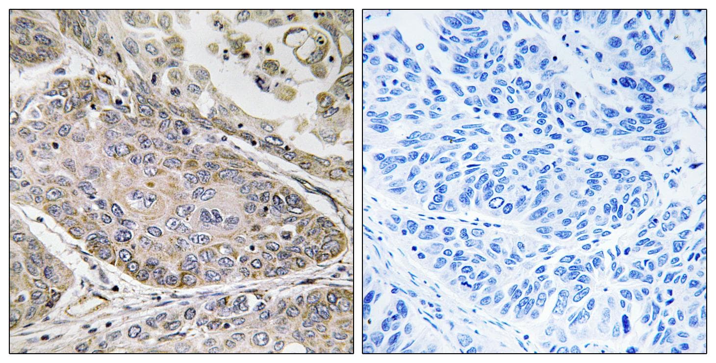 PLA2G4E Antibody