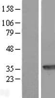 MAWDBP / PBLD Protein (Over-Expression Lysate Myc-DDK (Flag))