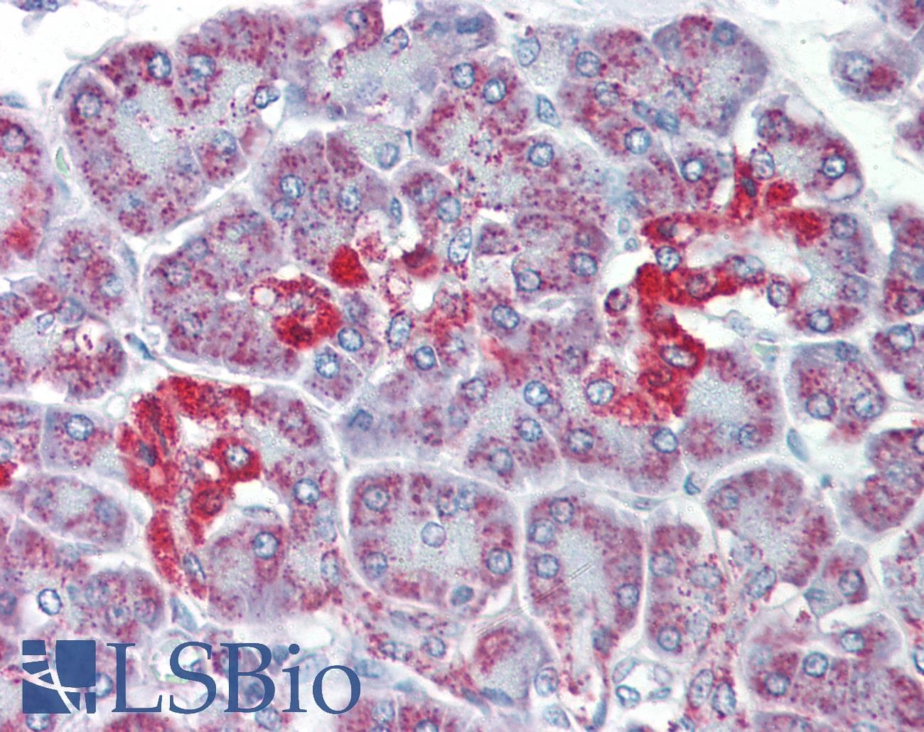 Polyclonal Rabbit anti-Human SLC39A5 / ZIP5 Antibody (aa38-87, IHC, WB)