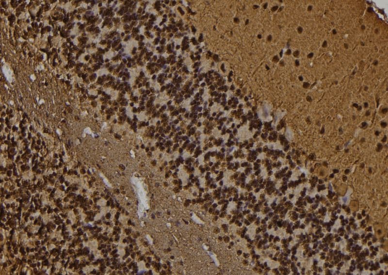 PPP1R1B / DARPP-32 Antibody