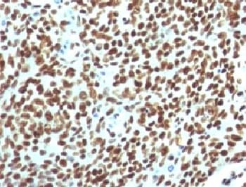 Nuclear Antigen Antibody (clone NUCM1-1)