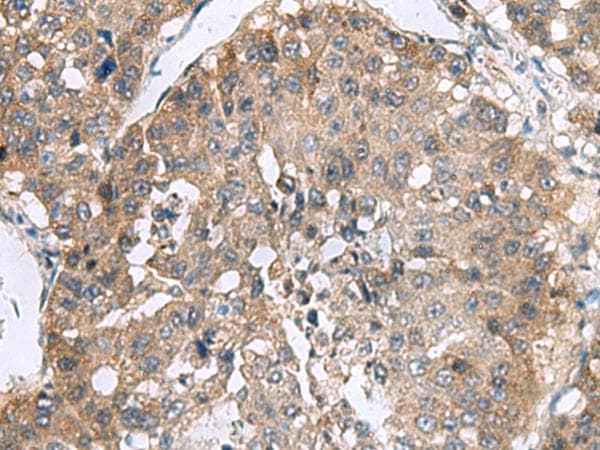 RPL18 / Ribosomal Protein L18 Antibody