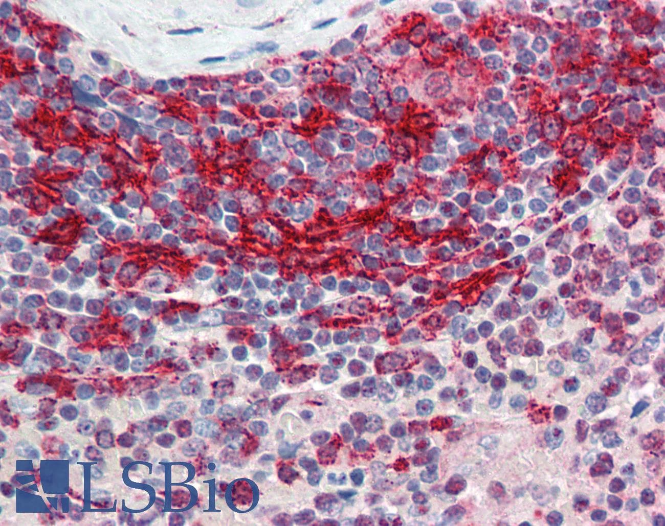 IHC-plus™ STAT6 Antibody (clone 6C10)