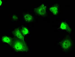 Monoclonal Mouse anti-Human SRR / Serine Racemase Antibody (clone OTI5G3, IHC, IF, WB)