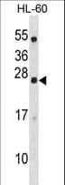 DYNAP Antibody (aa6-34)