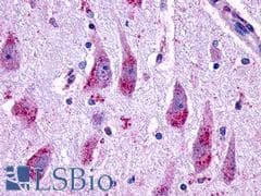 PathPlus™ GLP2R Antibody (N-Terminus)
