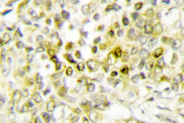 DLX5 Antibody (Glu126)