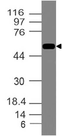 Vimentin Antibody