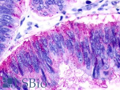 PathPlus™ Polyclonal Rabbit anti-Human GPR183 / EBI2 Antibody (Extracellular Domain, IHC)