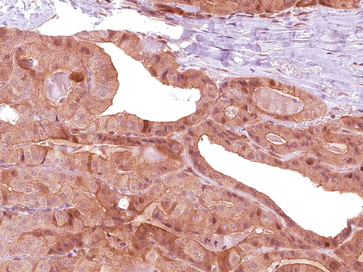 Lewis y / BG8 / CD174 Antibody (Ready-to-Use)