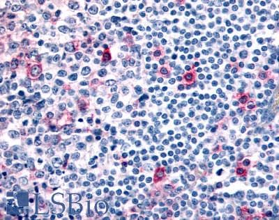IHC-plus™ CCR8 / CD198 Antibody (N-Terminus)