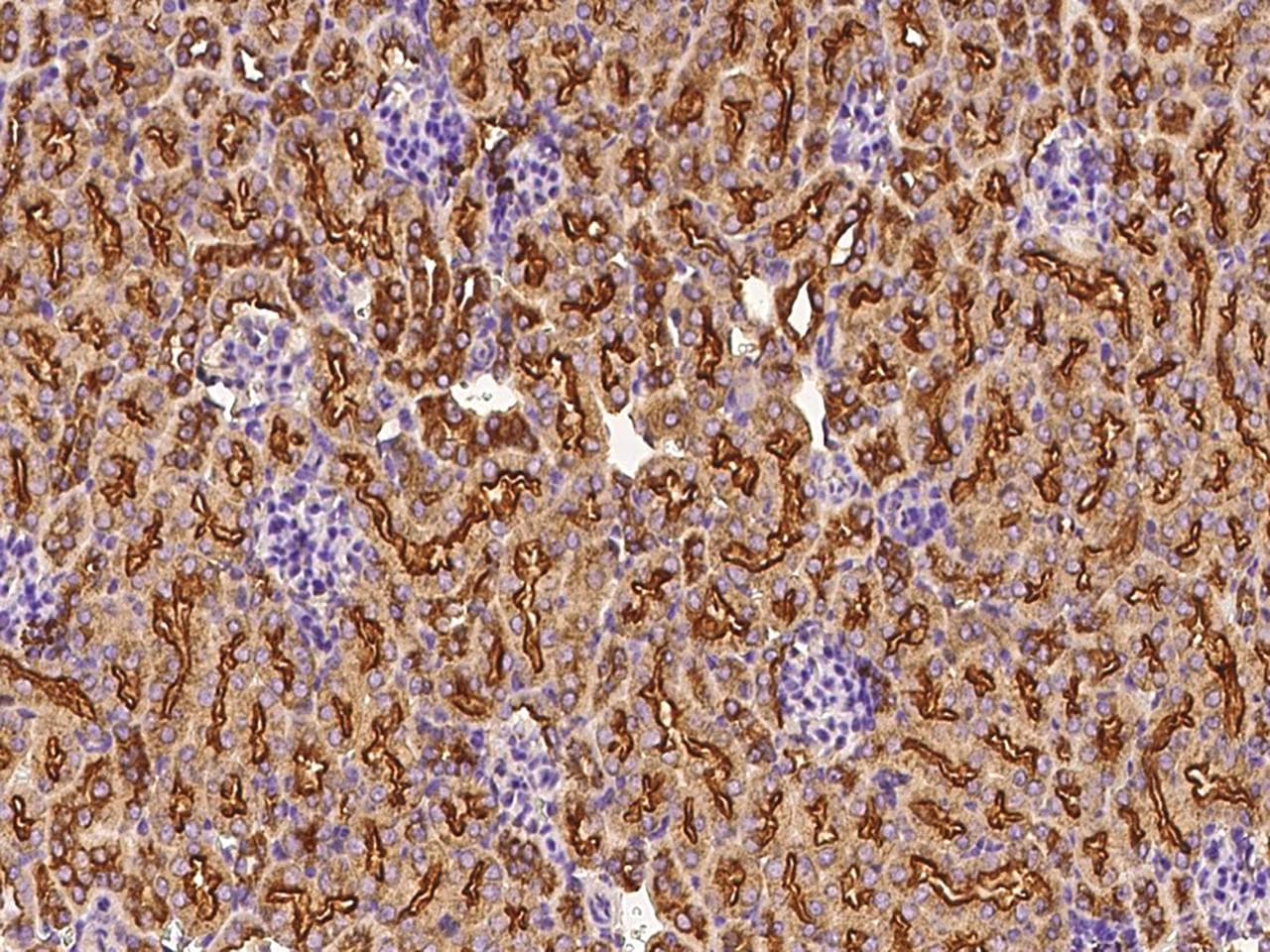 Polyclonal Rabbit anti-Mouse CLTC / Clathrin Heavy Chain Antibody (Preservative Free, IHC, WB)