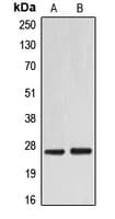 EIF4E Antibody (C-Terminus)