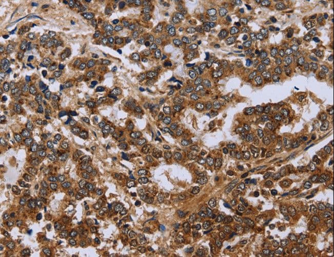 Polyclonal Rabbit anti-Human FH / Fumarase / MCL Antibody (IHC, WB)