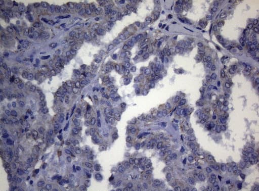 Monoclonal Mouse anti-Human CTSL / Cathepsin L Antibody (clone OTI8C12, Carrier-free, IHC, WB)