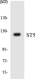 HTS1 / ST5 Antibody (aa388-437)