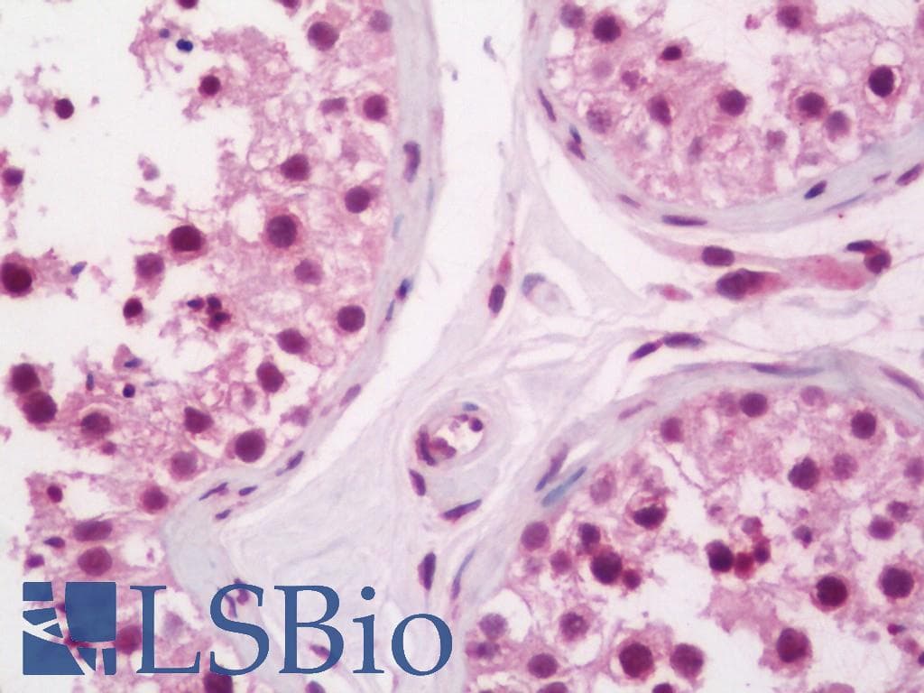 IHC-plus™ Polyclonal Rabbit anti-Human RAD51L3 / RAD51D Antibody (aa131-180, IHC, WB)