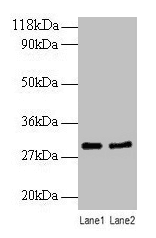IHC-plus™ RPL8 / Ribosomal Protein L8 Antibody
