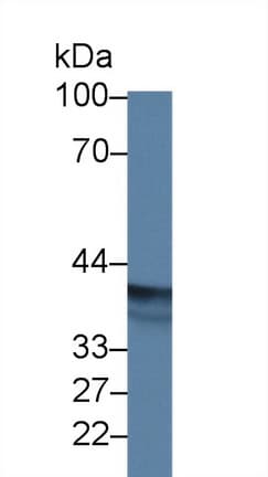 EPSTI1 Antibody (aa73-280, PE)