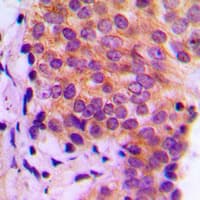 LGALS9 / Galectin 9 Antibody (Internal)
