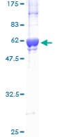Human CDK2 Protein (Recombinant GST)