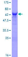 Human NANS Protein (Recombinant GST)