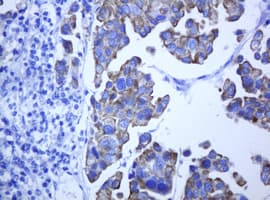 ABCB1 / MDR1 / P Glycoprotein Antibody (clone OTI2G1)