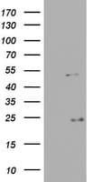 VEGFA / VEGF Antibody (aa206-412, clone OTI15C8)