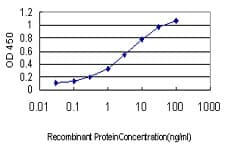 PathPlus™ SCGN / Secretagogin Antibody (clone 2G7)