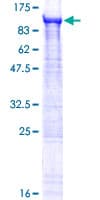 Human ZFYVE1 / DFCP1 Protein (Recombinant GST)