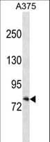 RXFP1/ LGR7 Antibody (aa685-713)