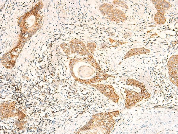 MT-CO2 Antibody