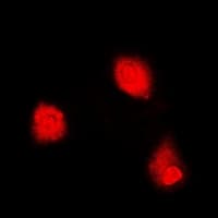 MTAP Antibody