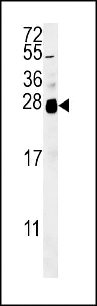 Polyclonal Rabbit anti-Human RNF114 / ZNF313 Antibody (aa167-193, IHC, WB)