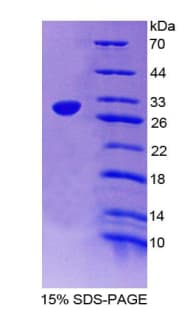 Human PDGF-BB Protein (Recombinant His-T7)