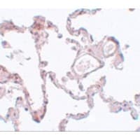 PLEKHM1 Antibody