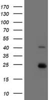 UBE2E3 Antibody (clone OTI6D3)