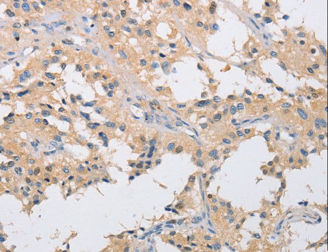 Polyclonal Rabbit anti-Human IKBKG / NEMO / IKK Gamma Antibody (IHC)