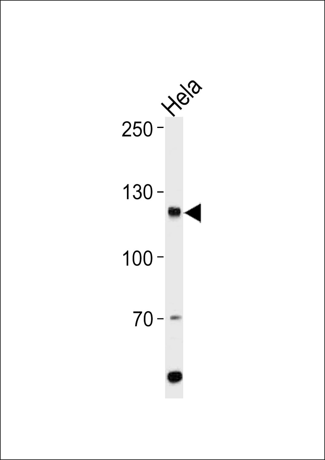 HIRA Antibody (aa431-461)