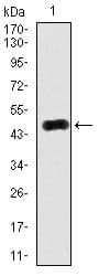 IHC-plus™ Ras-related protein Rab-4 (RAB4) Antibody (clone 4E+11)