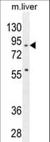 Polyclonal Rabbit anti-Human SPIRE2 Antibody (aa285-313, WB)