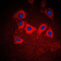 KRT10 / CK10 / Cytokeratin 10 Antibody (Internal)